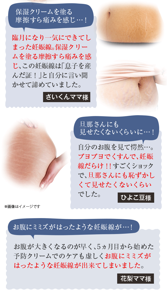 ノコアは妊娠線ができてしまって後悔しているママをたくさん見てきました…