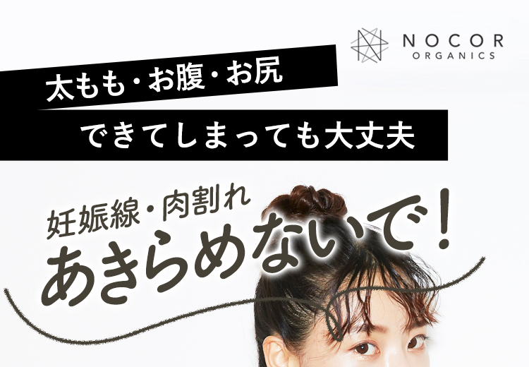 太もも・お尻、お腹 できてしまっても大丈夫！｜妊娠線・肉割れ あきらめないで！