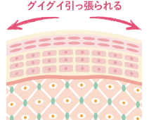 表皮がグイグイ引っ張られる